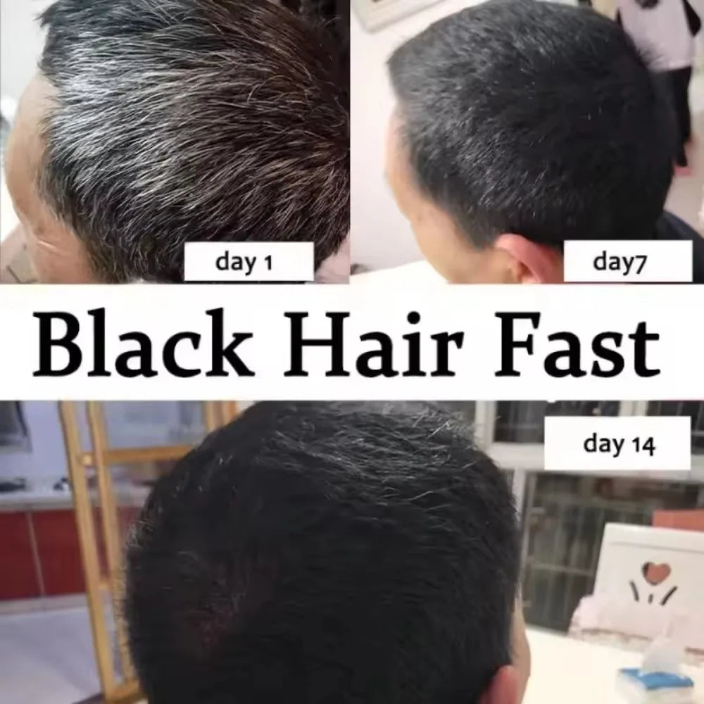 Natural Hair Care Essence Serum Anti Gray Nourish Repair For All Hair Types