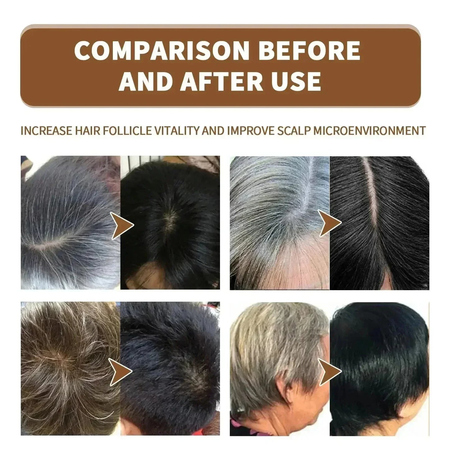 Natural Hair Care Essence Serum Anti Gray Nourish Repair For All Hair Types