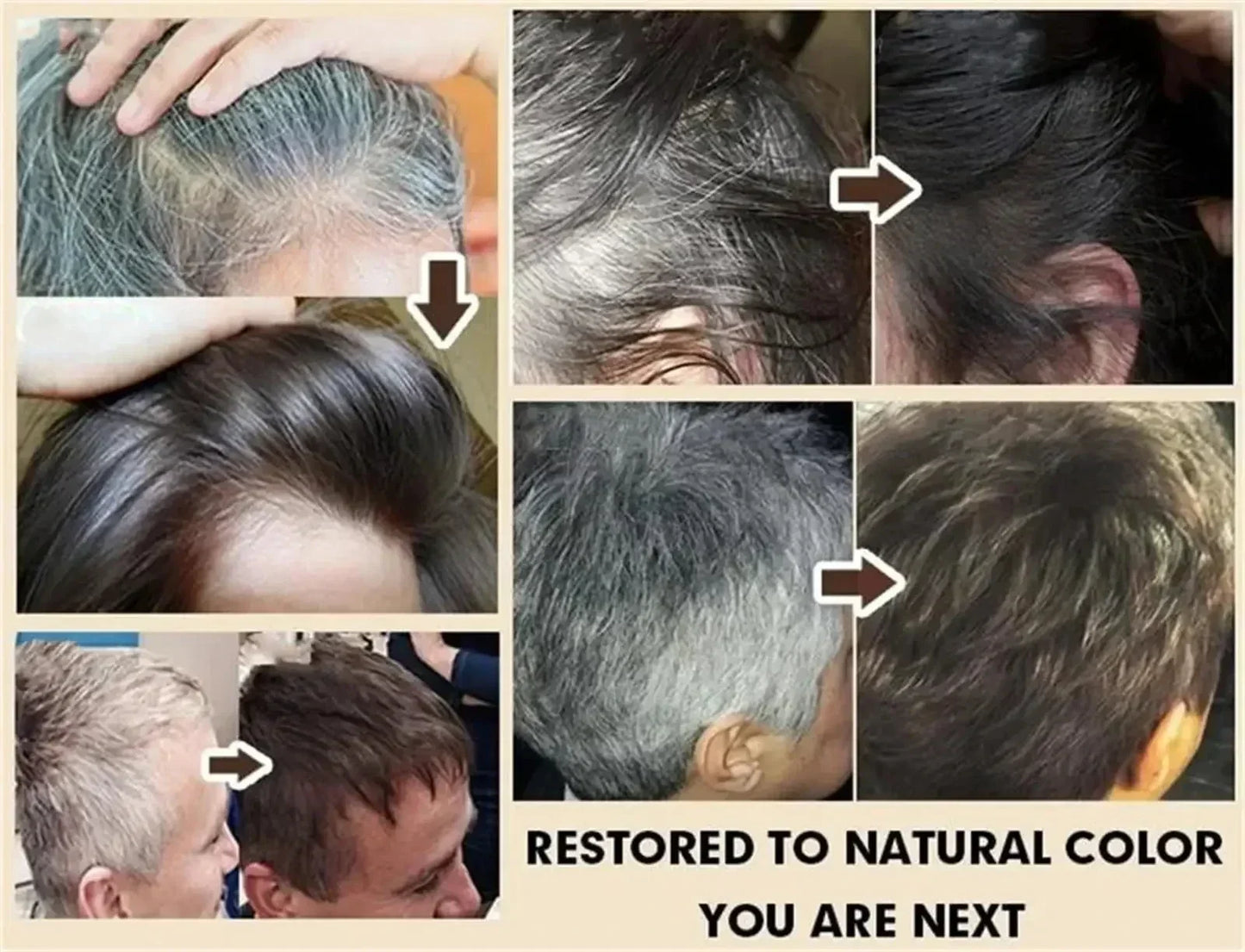 Natural Hair Care Essence Serum Anti Gray Nourish Repair For All Hair Types