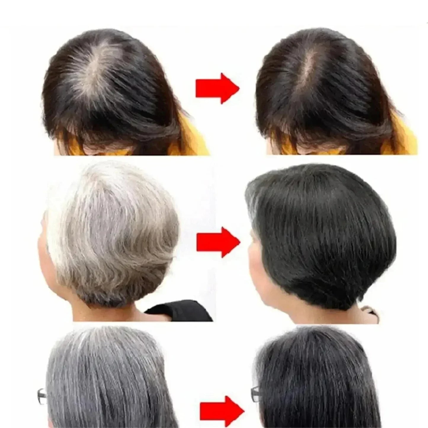 Natural Hair Care Essence Serum Anti Gray Nourish Repair For All Hair Types